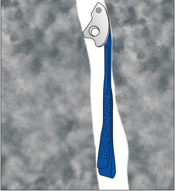 CAMP Tricam Placement Active 2 • Moja Gear